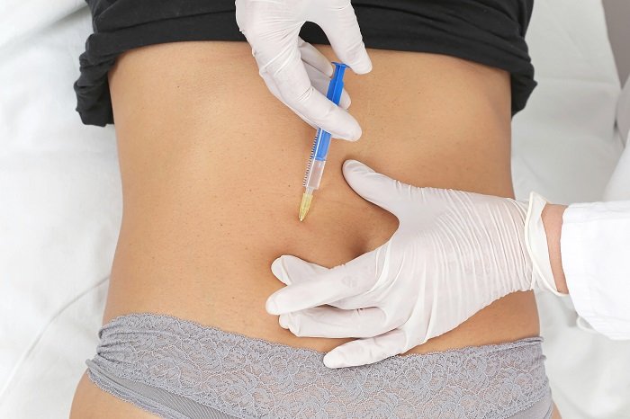 Top Clinics Offering Fat Dissolving Injections in Riyadh